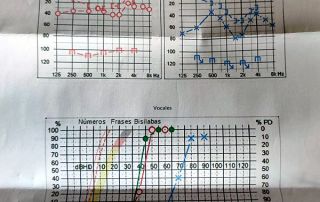 audición antes/hearing before qi gong