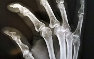 mano antes / hand before qi gong